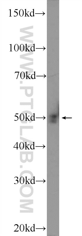Western Blot (WB) analysis of mouse testis tissue using GAS7 Polyclonal antibody (10072-1-AP)
