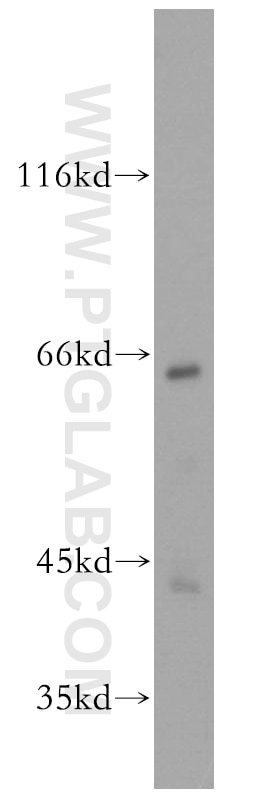 Western Blot (WB) analysis of mouse skeletal muscle tissue using GAS8 Polyclonal antibody (18270-1-AP)
