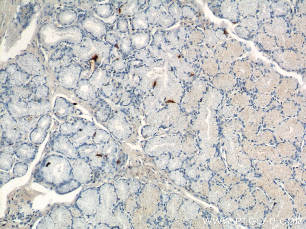 Immunohistochemistry (IHC) staining of human stomach tissue using Gastrin Polyclonal antibody (18143-1-AP)