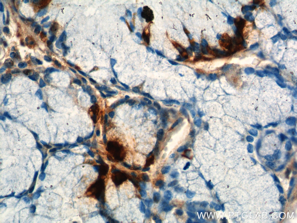 Immunohistochemistry (IHC) staining of human stomach tissue using Gastrin Polyclonal antibody (18143-1-AP)