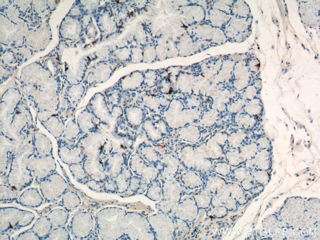 IHC staining of human stomach using 18143-1-AP