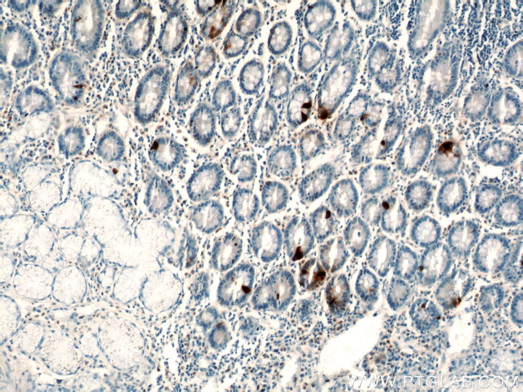 Immunohistochemistry (IHC) staining of human stomach tissue using Gastrin Polyclonal antibody (18143-1-AP)