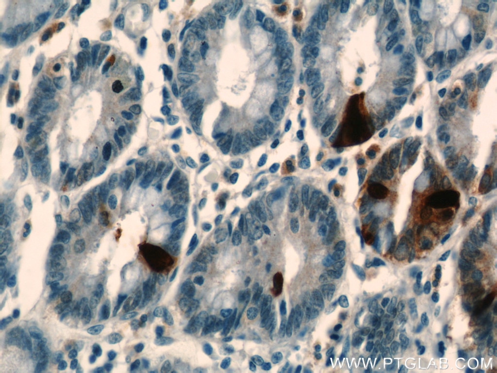 Immunohistochemistry (IHC) staining of human stomach tissue using Gastrin Polyclonal antibody (18143-1-AP)