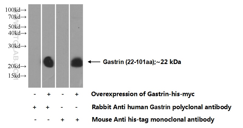 Gastrin Polyclonal antibody