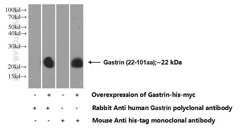 Gastrin