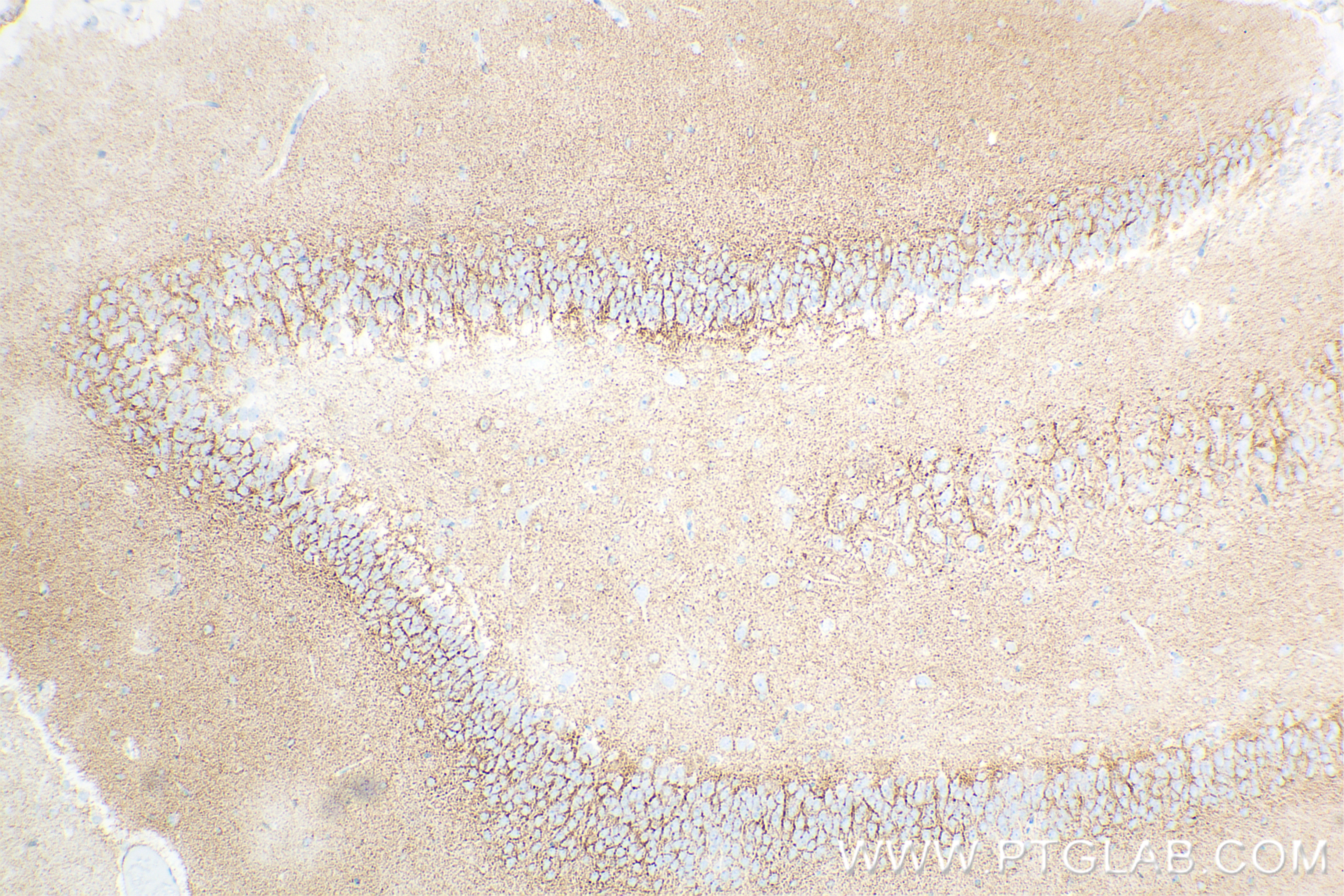 Immunohistochemistry (IHC) staining of rat brain tissue using GAT1 Recombinant antibody (85060-2-RR)