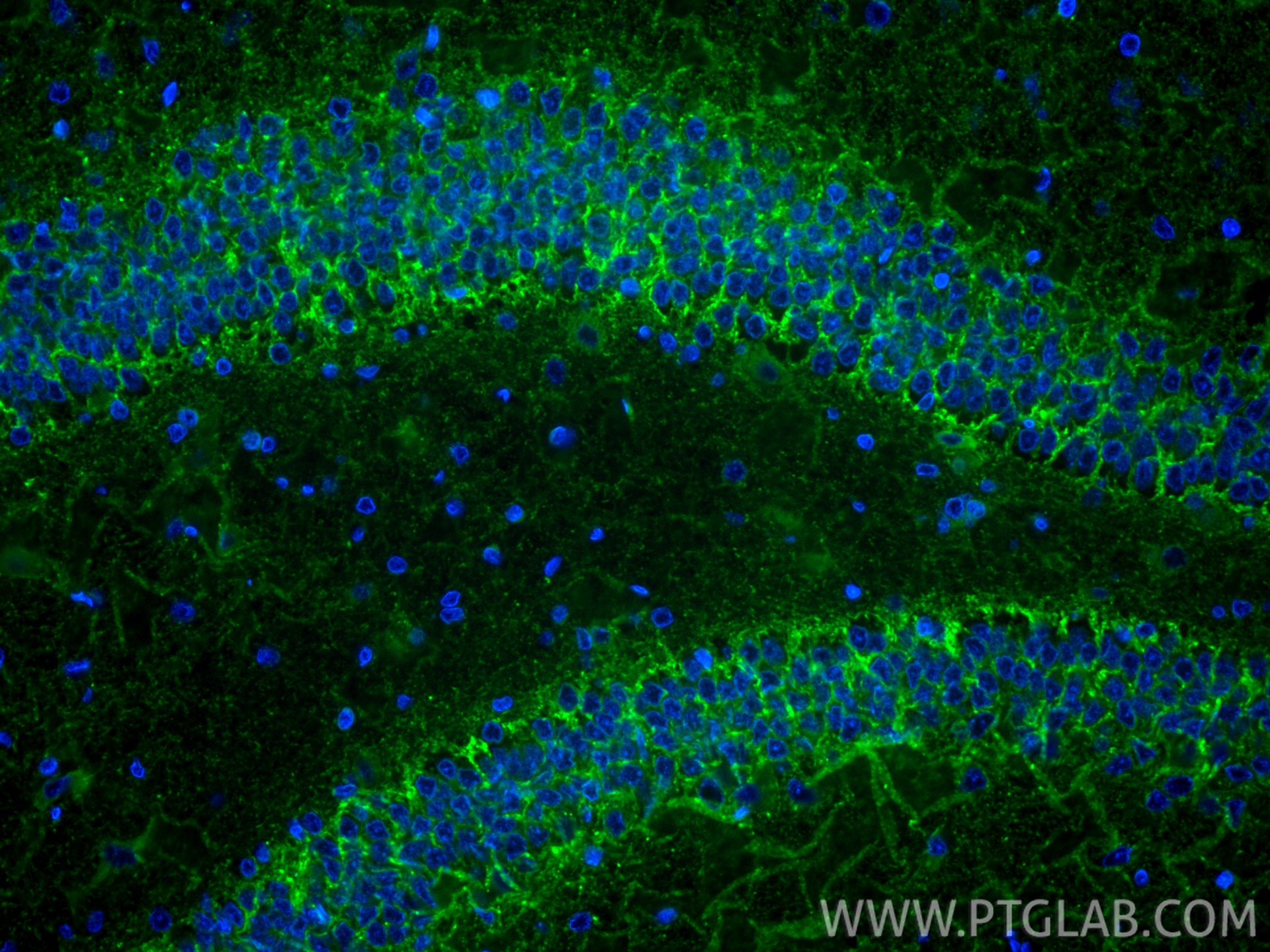 Immunofluorescent analysis of (4% PFA) fixed paraffin-embedded rat brain tissue using CoraLite® Plus 488 GAT1 antibody (CL488-85060-2, Clone: 242637D11 ) at dilution of 1:200. Heat mediated antigen retrieval with Tris-EDTA buffer (pH 9.0). Immunofluorescence (IF) / fluorescent staining of rat brain tissue using CoraLite® Plus 488-conjugated GAT1 Recombinant mon (CL488-85060-2)