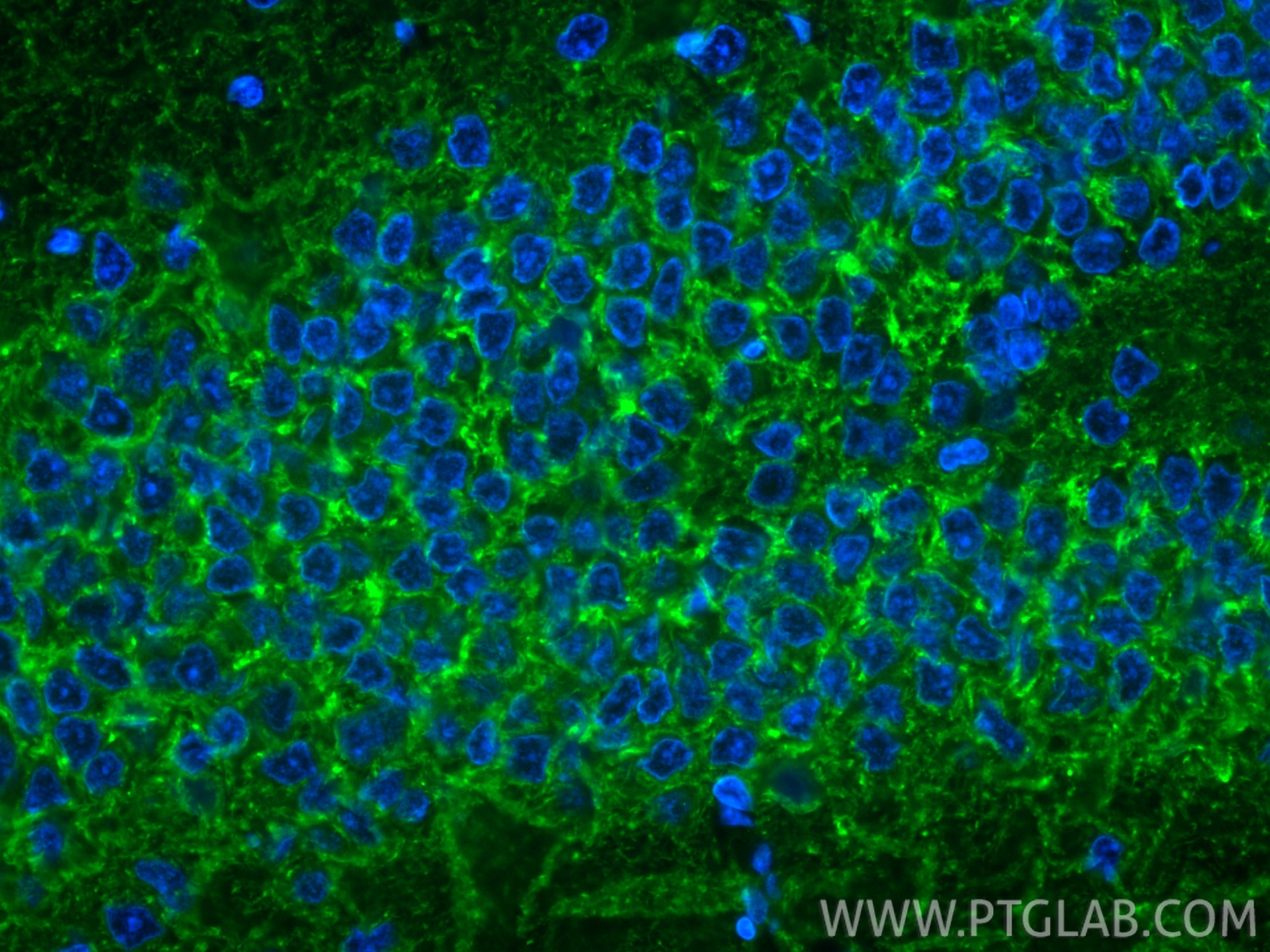 Immunofluorescent analysis of (4% PFA) fixed paraffin-embedded rat brain tissue using CoraLite® Plus 488 GAT1 antibody (CL488-85060-2, Clone: 242637D11 ) at dilution of 1:200. Heat mediated antigen retrieval with Tris-EDTA buffer (pH 9.0). Immunofluorescence (IF) / fluorescent staining of rat brain tissue using CoraLite® Plus 488-conjugated GAT1 Recombinant mon (CL488-85060-2)