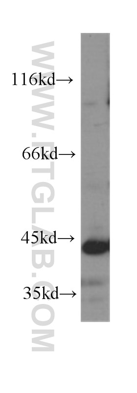 GATA1 Monoclonal antibody