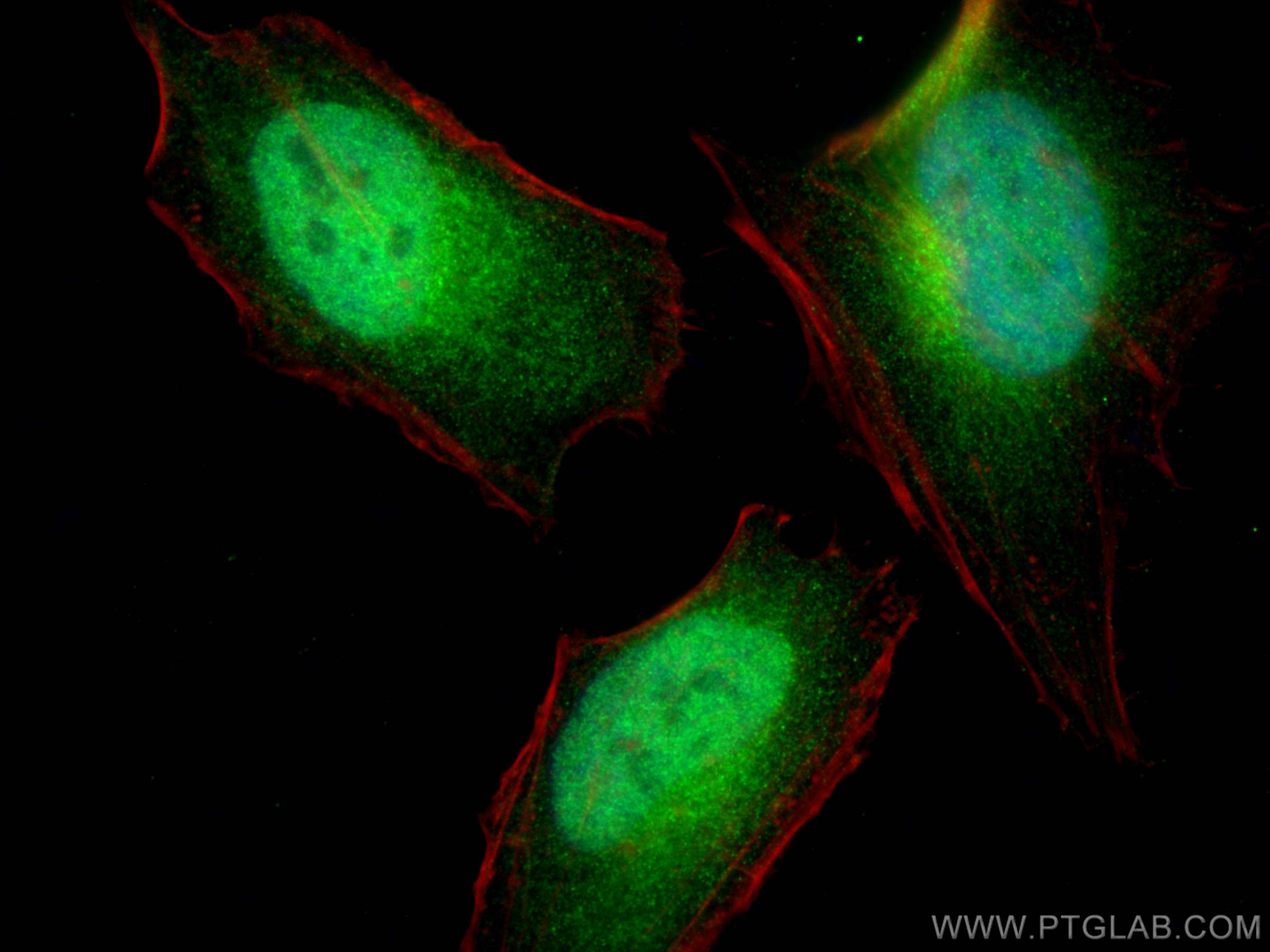 Immunofluorescence (IF) / fluorescent staining of HeLa cells using GATA2 Polyclonal antibody (11103-1-AP)