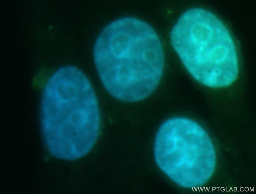 Immunofluorescence (IF) / fluorescent staining of HepG2 cells using GATA2 Polyclonal antibody (11103-1-AP)