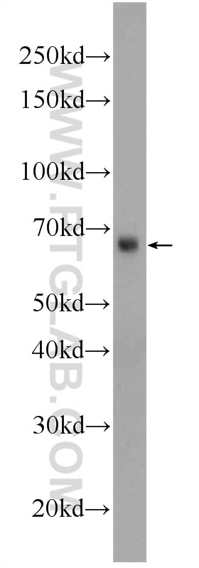 Western Blot (WB) analysis of rat liver tissue using GATA2 Polyclonal antibody (11103-1-AP)