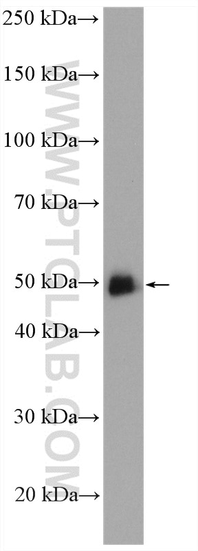 WB analysis of HeLa using 11103-1-AP