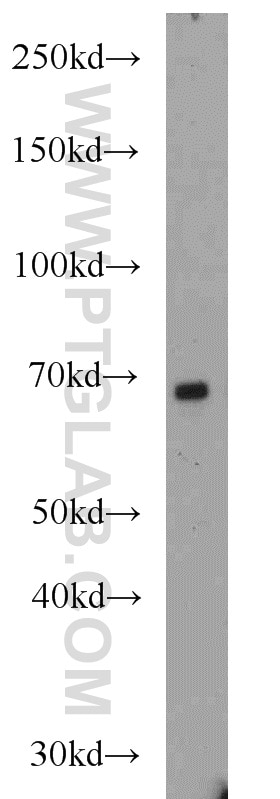 WB analysis of mouse liver using 11103-1-AP