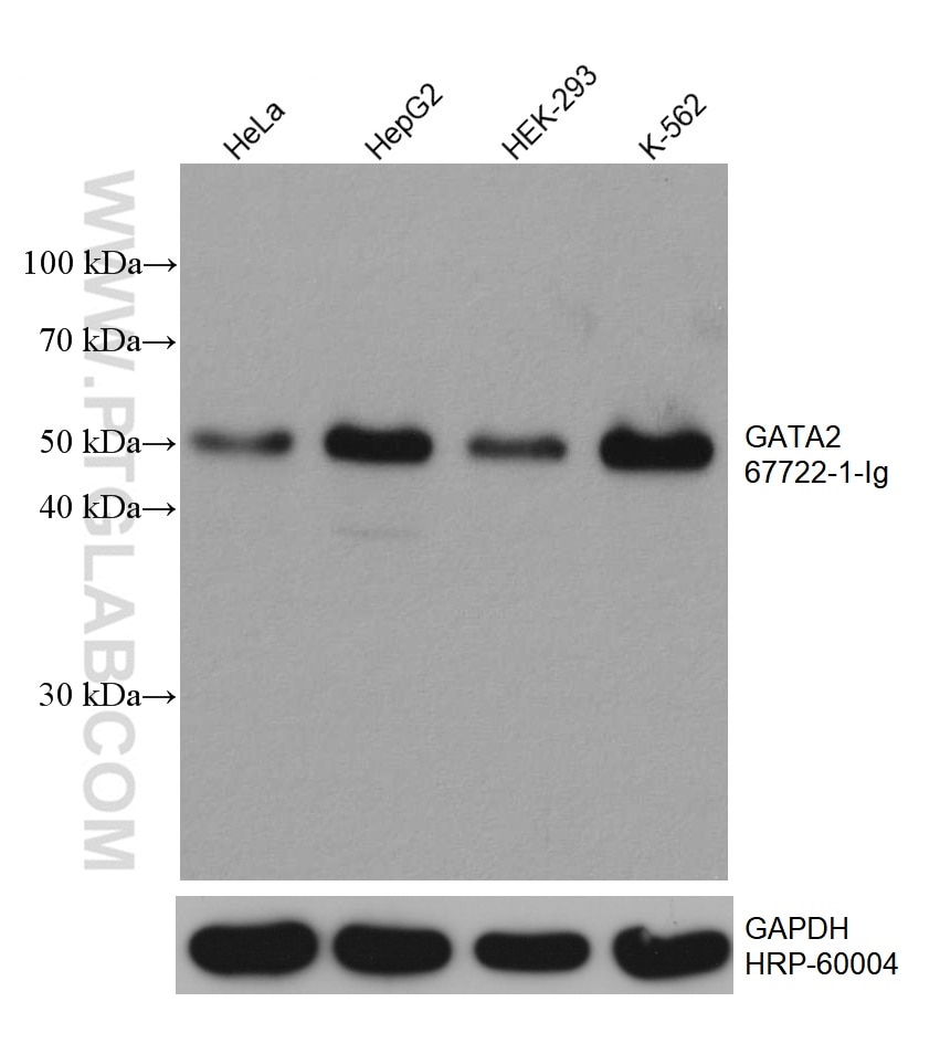 WB analysis using 67722-1-Ig