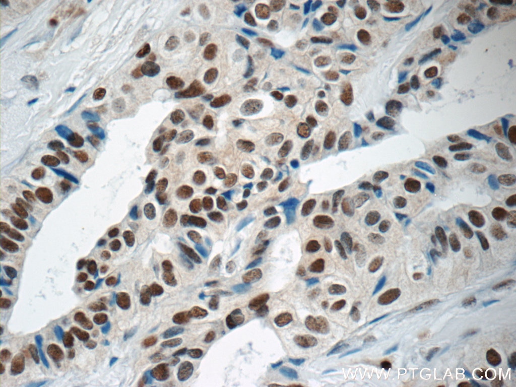 GATA3 Polyclonal antibody