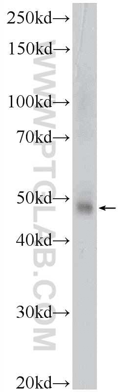 WB analysis of mouse thymus using 22343-1-AP