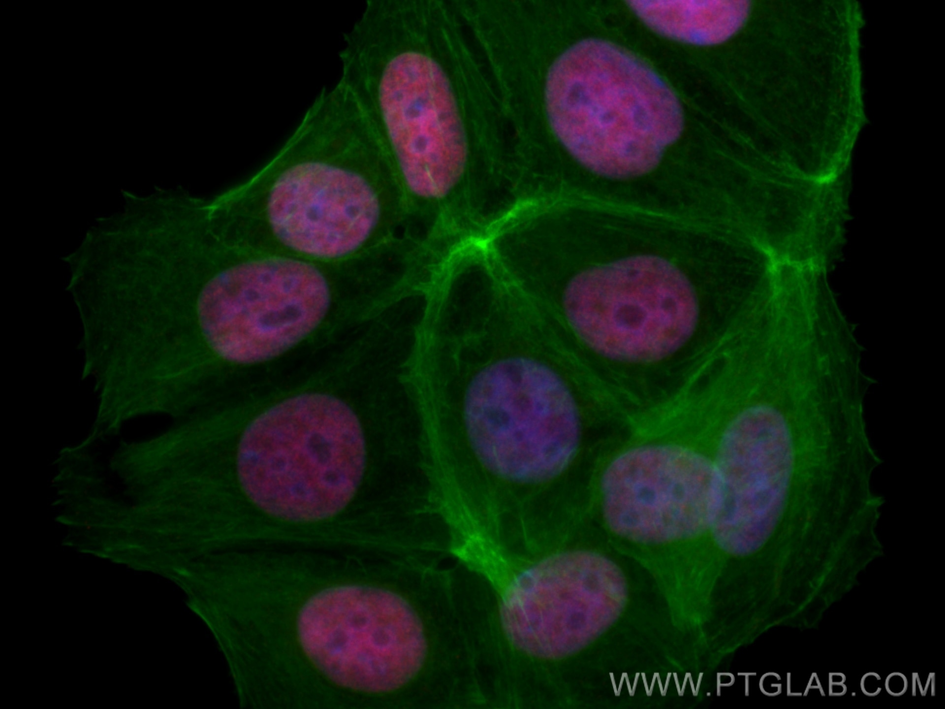 IF Staining of MCF-7 using CL594-66400