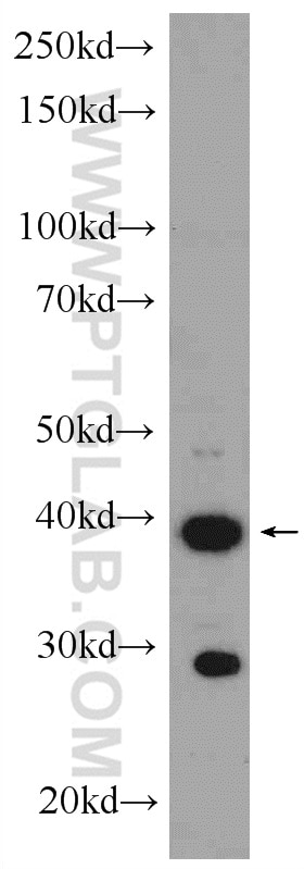 WB analysis of mouse heart using 19530-1-AP