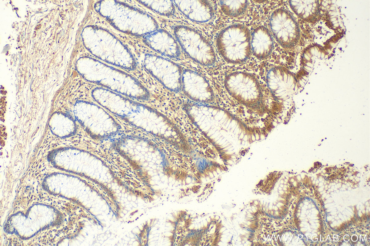 Immunohistochemistry (IHC) staining of human colon tissue using GATA5 Polyclonal antibody (55433-1-AP)