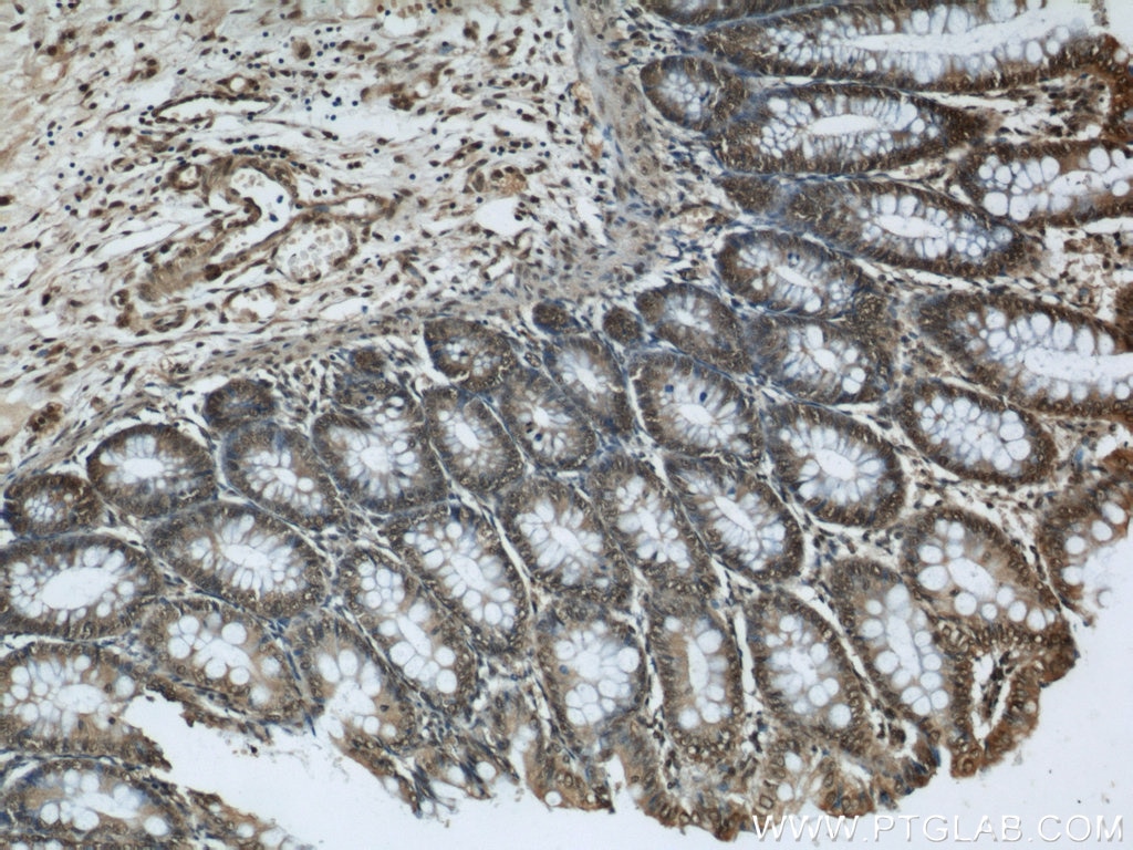 Immunohistochemistry (IHC) staining of human colon tissue using GATA5 Polyclonal antibody (55433-1-AP)