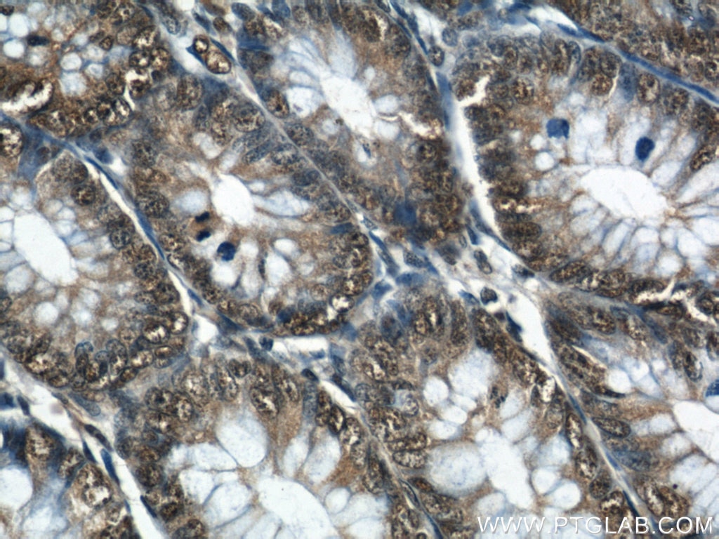 Immunohistochemistry (IHC) staining of human colon tissue using GATA5 Polyclonal antibody (55433-1-AP)
