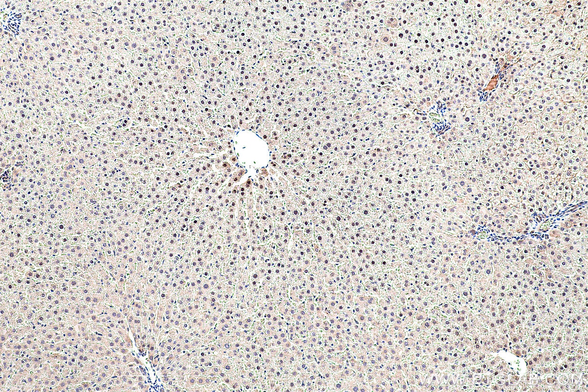 Immunohistochemistry (IHC) staining of rat liver tissue using GATA6 Polyclonal antibody (55435-1-AP)