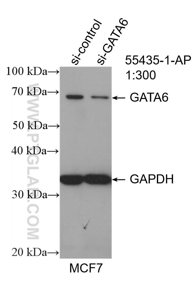 Western Blot (WB) analysis of MCF-7 cells using GATA6 Polyclonal antibody (55435-1-AP)