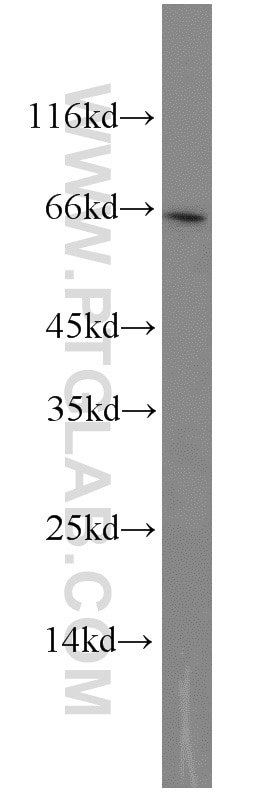 Western Blot (WB) analysis of BxPC-3 cells using GATA6 Polyclonal antibody (55435-1-AP)
