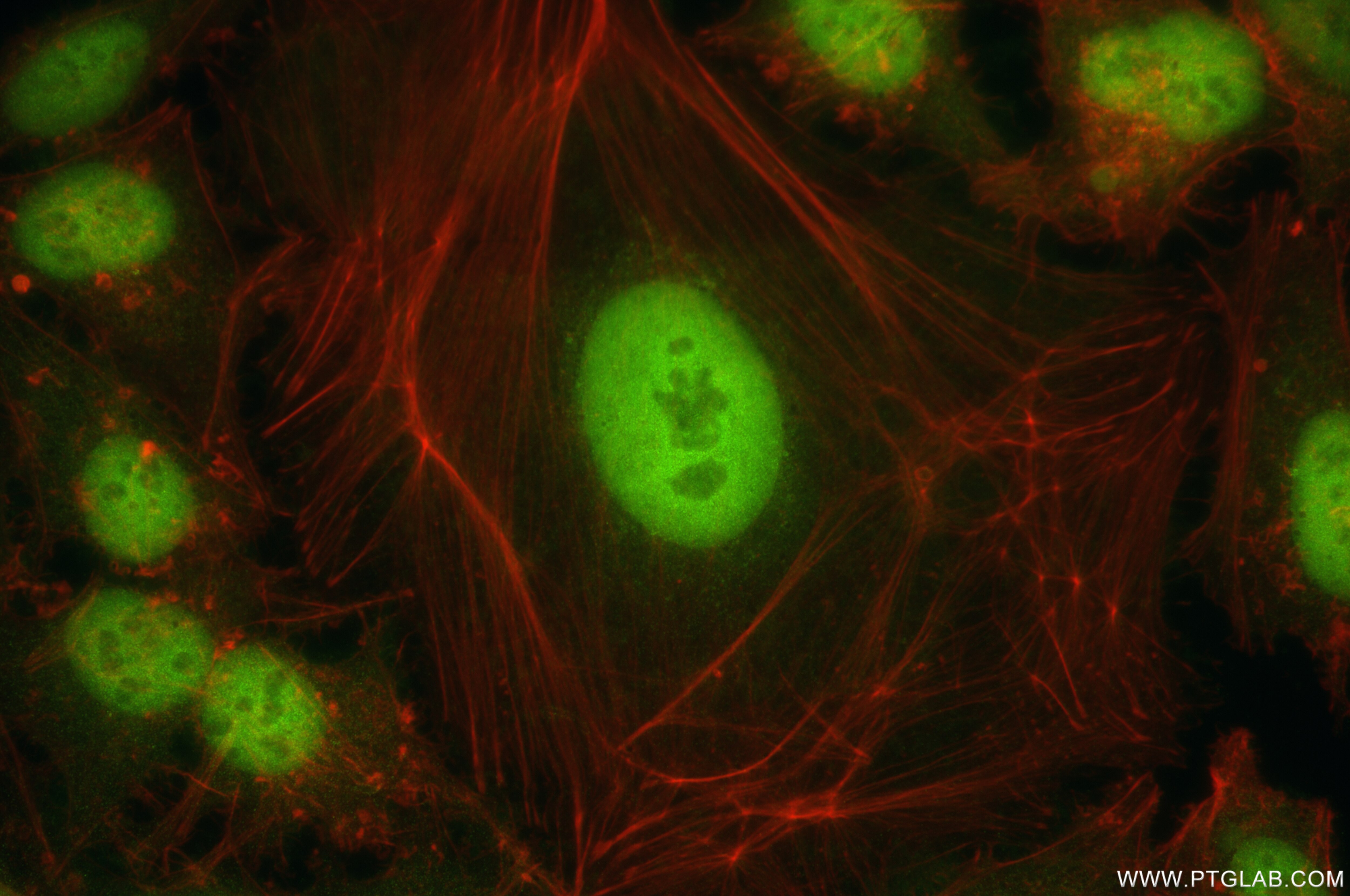 Immunofluorescence (IF) / fluorescent staining of HeLa cells using GATA6 Recombinant antibody (84987-3-RR)