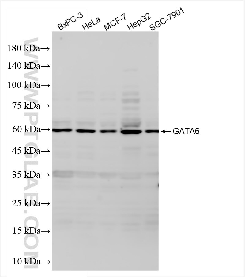 Western Blot (WB) analysis of various lysates using GATA6 Recombinant antibody (84987-3-RR)