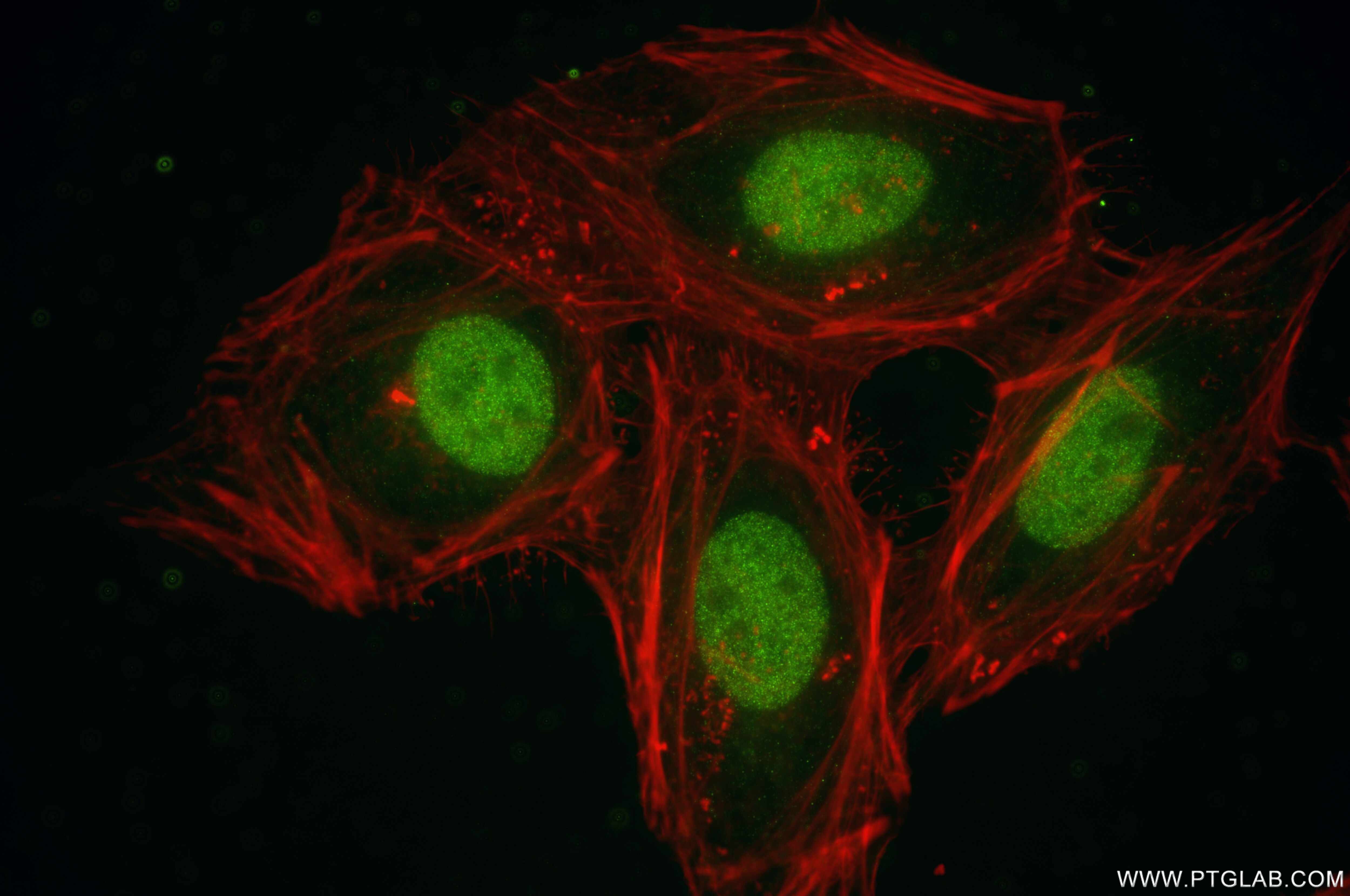 Immunofluorescence (IF) / fluorescent staining of HeLa cells using GATA6 Recombinant antibody (84987-5-RR)