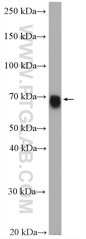 Western Blot (WB) analysis of K-562 cells using GATAD2A Polyclonal antibody (12294-1-AP)