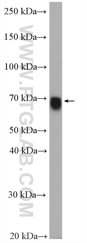 WB analysis of K-562 using 12294-1-AP