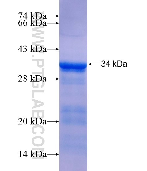GATAD2A fusion protein Ag19238 SDS-PAGE