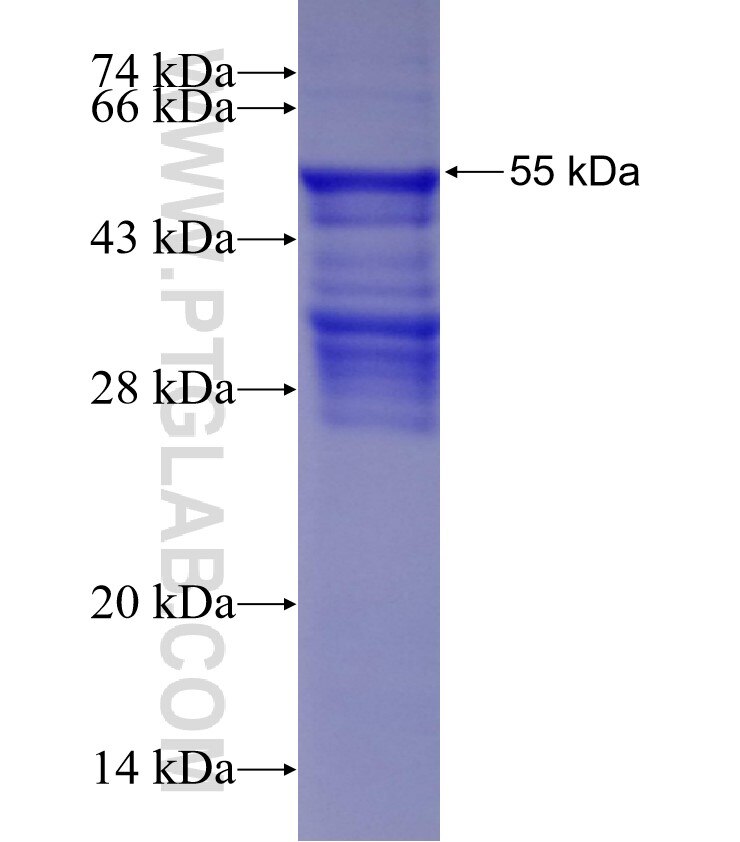 GATAD2A fusion protein Ag2947 SDS-PAGE