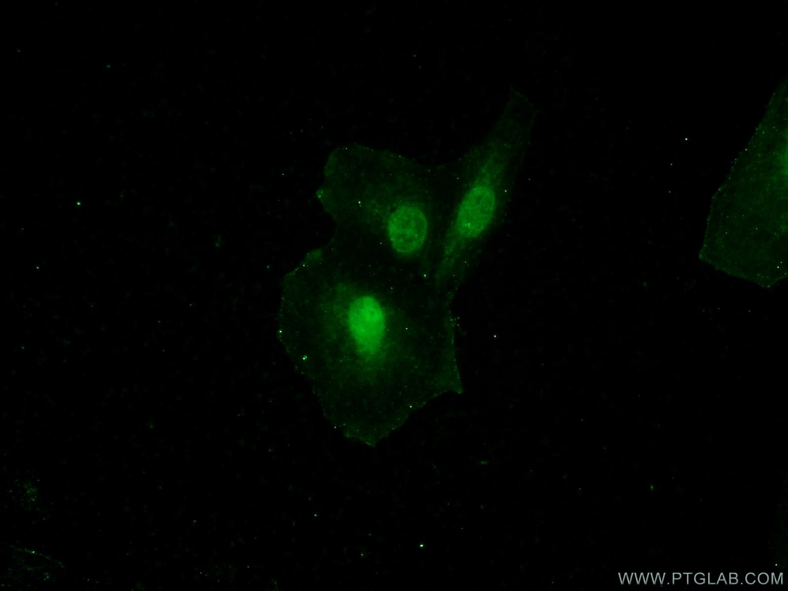 Immunofluorescence (IF) / fluorescent staining of A549 cells using GATAD2B Polyclonal antibody (25679-1-AP)