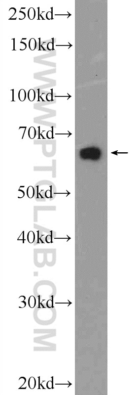 Western Blot (WB) analysis of PC-3 cells using GATAD2B Polyclonal antibody (25679-1-AP)
