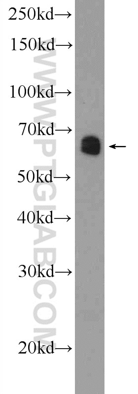 Western Blot (WB) analysis of HEK-293 cells using GATAD2B Polyclonal antibody (25679-1-AP)
