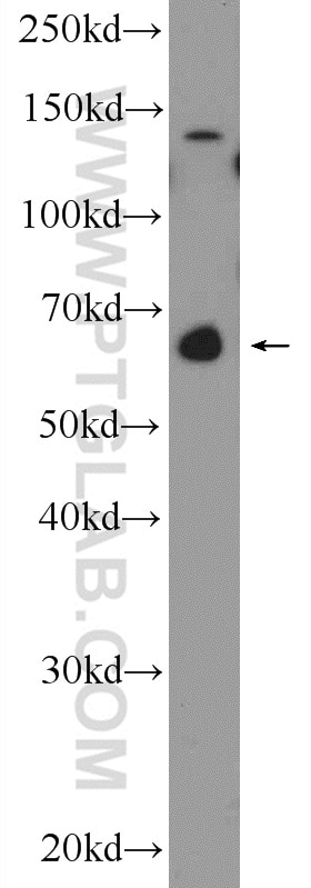 Western Blot (WB) analysis of K-562 cells using GATAD2B Polyclonal antibody (25679-1-AP)