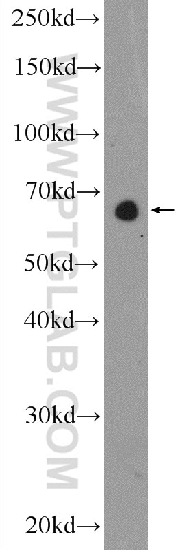 Western Blot (WB) analysis of A549 cells using GATAD2B Polyclonal antibody (25679-1-AP)