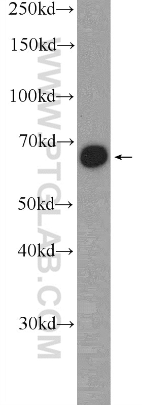 Western Blot (WB) analysis of MCF-7 cells using GATAD2B Polyclonal antibody (25679-1-AP)