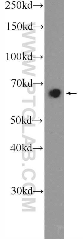 Western Blot (WB) analysis of HeLa cells using GATAD2B Polyclonal antibody (25679-1-AP)