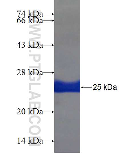 GATAD2B fusion protein Ag22615 SDS-PAGE