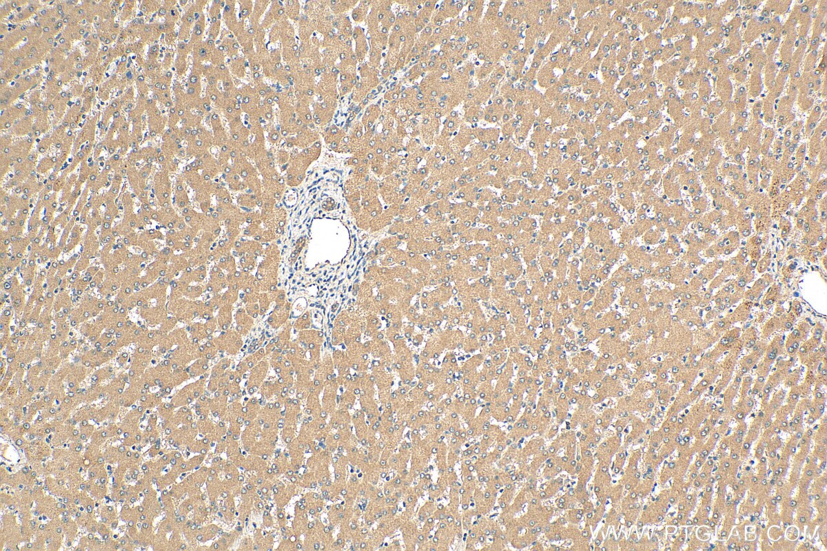 IHC staining of human liver using 23183-1-AP