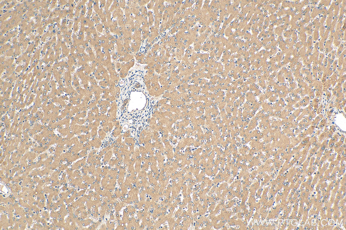 Immunohistochemistry (IHC) staining of human liver tissue using GATC Polyclonal antibody (23183-1-AP)