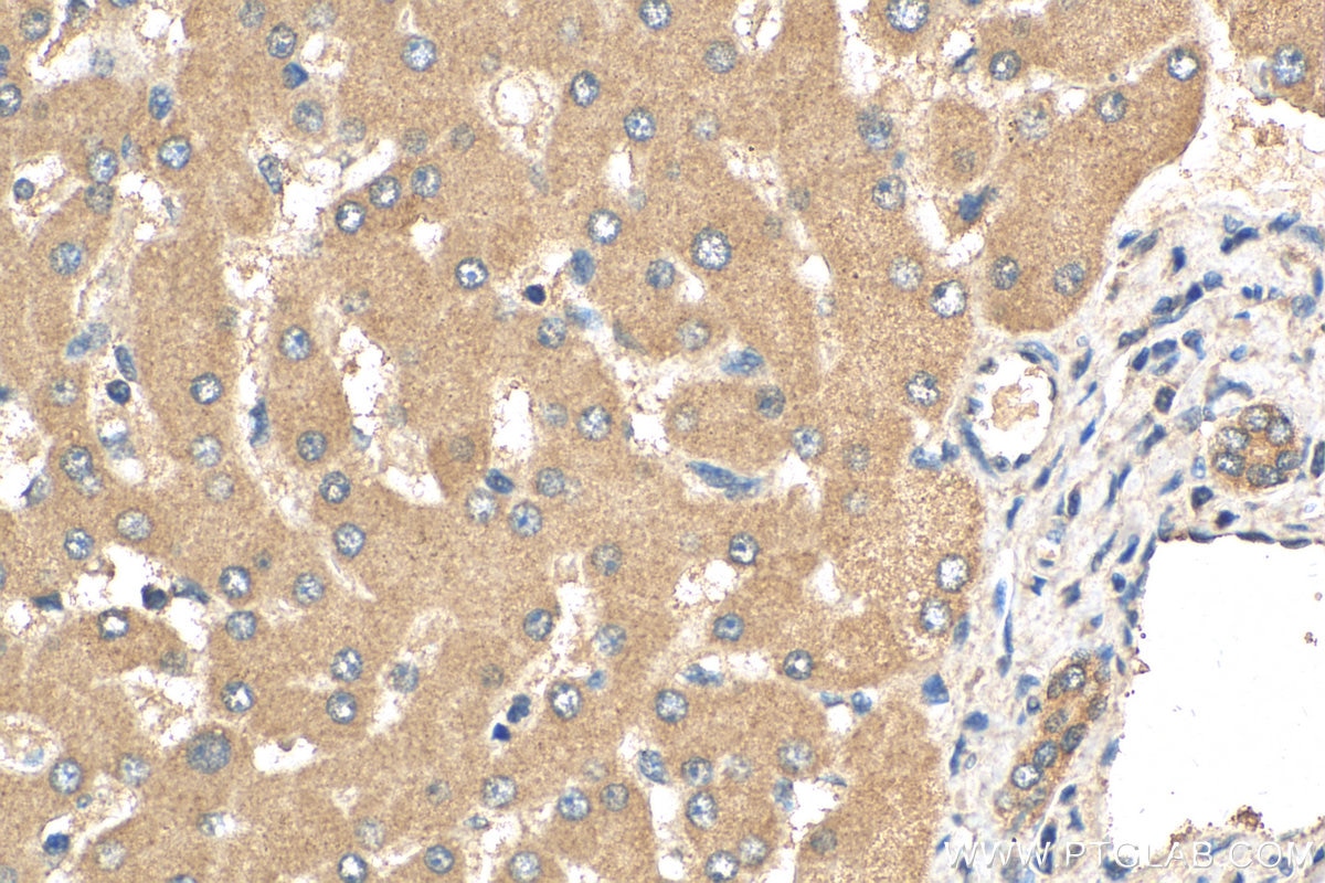 Immunohistochemistry (IHC) staining of human liver tissue using GATC Polyclonal antibody (23183-1-AP)