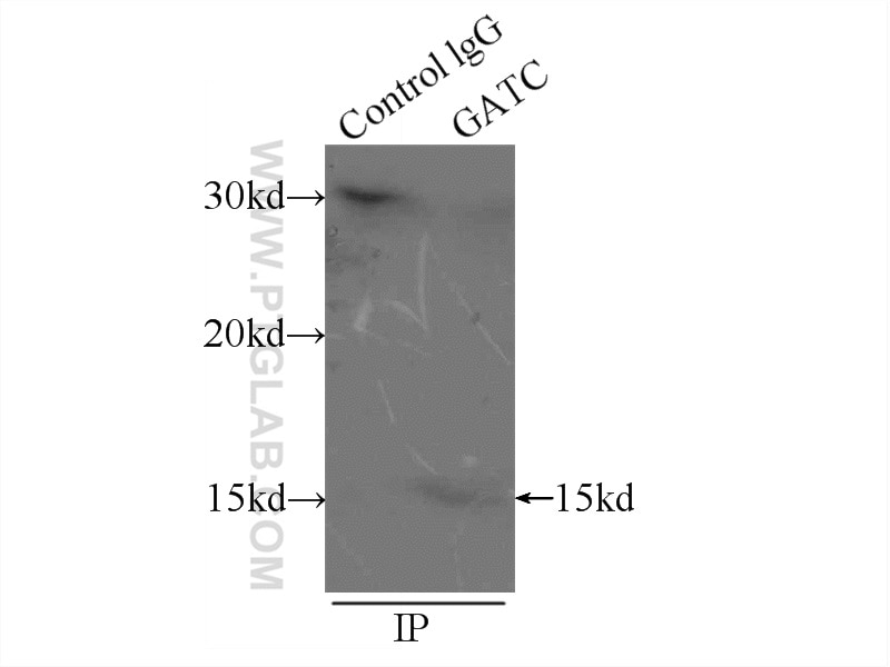 Immunoprecipitation (IP) experiment of mouse liver tissue using GATC Polyclonal antibody (23183-1-AP)