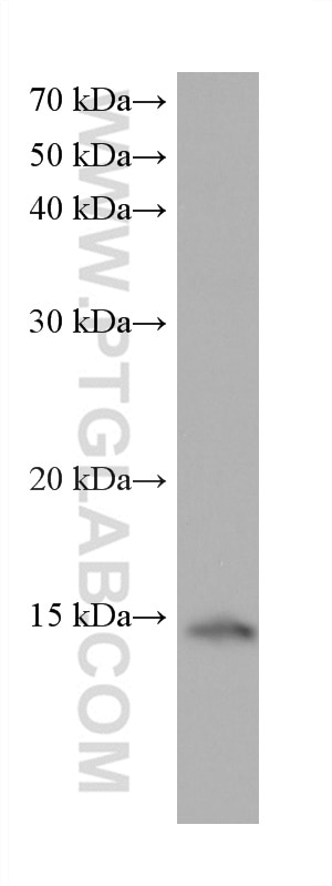 Western Blot (WB) analysis of A549 cells using GATC Monoclonal antibody (68405-1-Ig)