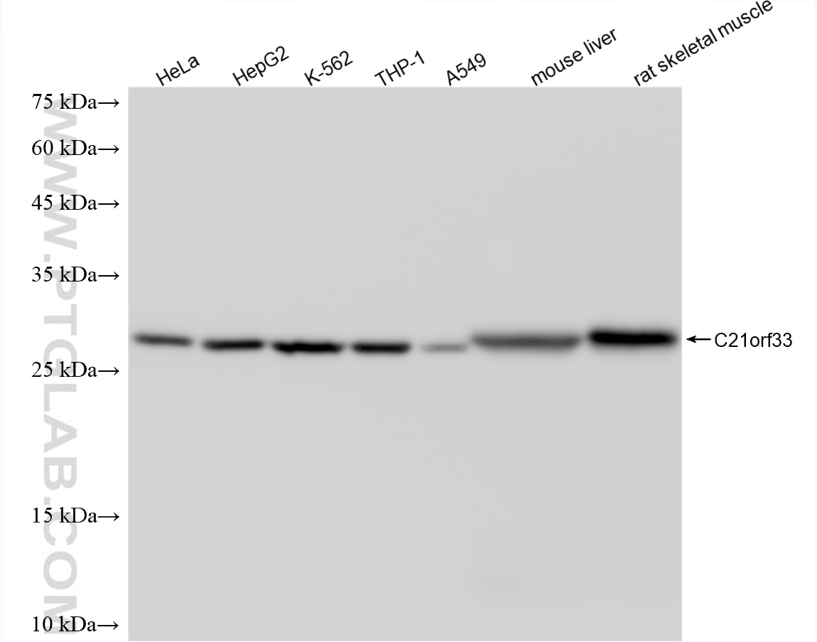 WB analysis using 88088-1-RR (same clone as 88088-1-PBS) Western Blot (WB) analysis of various lysates using GATD3 Recombinant monoclonal antibody (88088-1-RR)